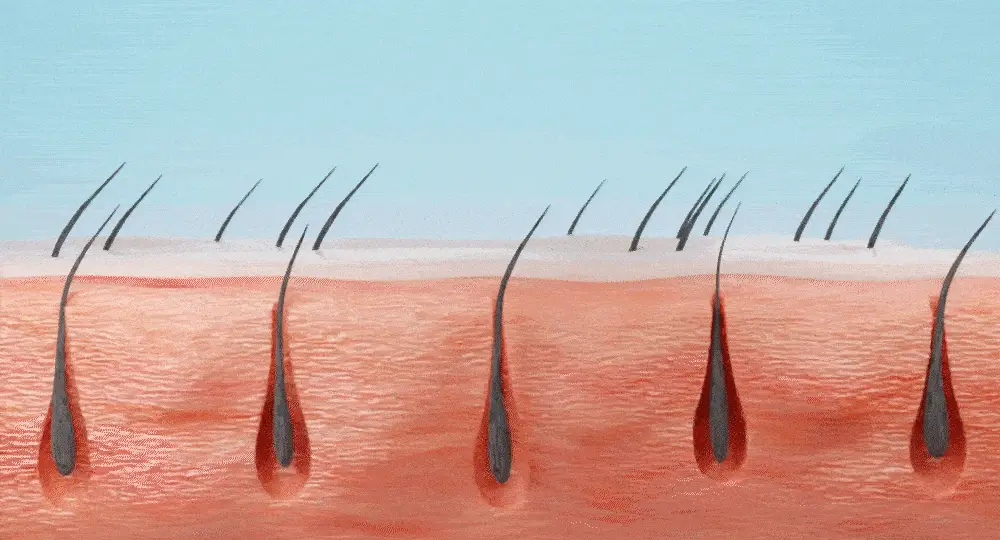 [포켓몬 에디션][비듬/각질케어]릴리이브 스칼프턴 시카 PDRN 브러쉬 앰플 100ml 2종 택1 상세페이지 60